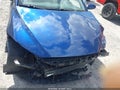 Photo 6 of 17 — 2017 Hyundai Elantra
