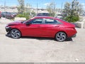 Photo 14 of 21 — 2025 Hyundai Elantra