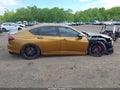 Photo 13 of 17 — 2021 Acura TLX