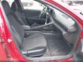 2025 Hyundai Elantra — photo 5 of 17 | VIN KMHLM4DG0SU927281