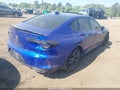 2021 Acura TLX — photo 4 of 16 | VIN 19UUB5F58MA014595