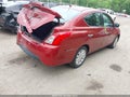 Photo 4 of 11 — 2017 Nissan Versa