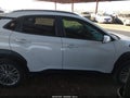 Photo 14 of 17 — 2018 Hyundai Kona