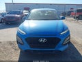 Photo 6 of 16 — 2019 Hyundai Kona