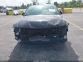 2025 Hyundai Elantra — photo 6 of 17 | VIN KMHLM4DG4SU910306