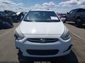 2015 Hyundai Accent — photo 12 of 16 | VIN KMHCT4AE2FU896613