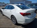 2015 Acura TLX — photo 3 of 16 | VIN 19UUB2F54FA026387