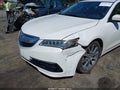 2015 Acura TLX — photo 6 of 16 | VIN 19UUB2F54FA026387