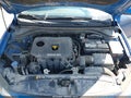 Photo 10 of 16 — 2018 Hyundai Elantra