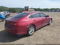 Photo 4 of 17 — 2017 Chevrolet Malibu