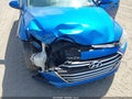 Photo 6 of 16 — 2017 Hyundai Elantra