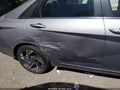 Photo 6 of 20 — 2025 Hyundai Elantra