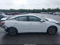 Photo 13 of 16 — 2025 Nissan Sentra