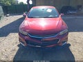 2018 Chevrolet Malibu Limited — photo 12 of 16 | VIN 1G1ZD5ST0JF160788