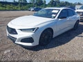 2023 Acura TLX — photo 2 of 17 | VIN 19UUB7F03PA001791