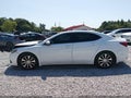2016 Acura TLX — photo 14 of 16 | VIN 19UUB1F30GA009144