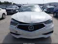 2020 Acura TLX — photo 11 of 17 | VIN 19UUB1F53LA015063