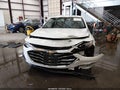 2022 Chevrolet Malibu — photo 12 of 16 | VIN 1G1ZC5ST4NF179935