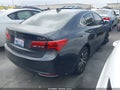 2015 Acura TLX — photo 4 of 21 | VIN 19UUB1F37FA019359