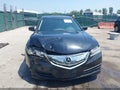 2015 Acura TLX — photo 12 of 21 | VIN 19UUB2F31FA008380