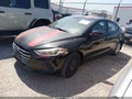 Photo 2 of 11 — 2017 Hyundai Elantra