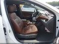 2018 Chevrolet Malibu — photo 5 of 16 | VIN 1G1ZE5SX9JF116367