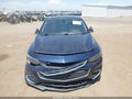 Photo 6 of 16 — 2018 Chevrolet Malibu