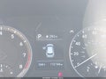 2020 Hyundai Kona — photo 16 of 17 | VIN KM8K12AA9LU438582