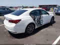 2015 Acura TLX — photo 4 of 17 | VIN 19UUB2F50FA005813