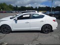 2018 Acura ILX — photo 15 of 17 | VIN 19UDE2F34JA004789