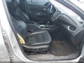 2017 Chevrolet Malibu — photo 5 of 17 | VIN 1G1ZE5ST1HF242827