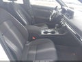 2022 Honda Civic — photo 5 of 17 | VIN 2HGFE2F51NH554582