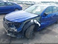 2021 Acura TLX — photo 6 of 17 | VIN 19UUB5F50MA012968