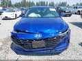 2021 Hyundai Elantra — photo 12 of 18 | VIN 5NPLM4AG8MH004472