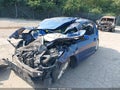 2017 Kia Forte — photo 2 of 16 | VIN 3KPFL4A7XHE137485