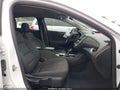 2022 Chevrolet Malibu — photo 5 of 16 | VIN 1G1ZD5ST0NF124895