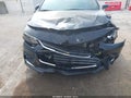 2018 Chevrolet Malibu Limited — photo 6 of 16 | VIN 1G1ZD5STXJF161897