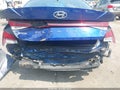 2022 Hyundai Elantra — photo 6 of 16 | VIN 5NPLM4AGXNH081880