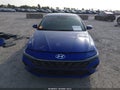 2025 Hyundai Elantra — photo 13 of 20 | VIN KMHLS4DG7SU946531
