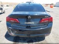2016 Acura TLX — photo 17 of 17 | VIN 19UUB1F59GA012125
