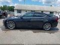 2015 Acura TLX — photo 14 of 16 | VIN 19UUB2F30FA026241