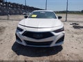 2021 Acura TLX — photo 13 of 17 | VIN 19UUB5F38MA003837
