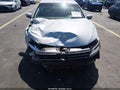 2017 Volkswagen Jetta — photo 6 of 16 | VIN 3VW2B7AJ1HM376599