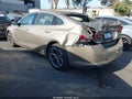 2023 Chevrolet Malibu — photo 3 of 16 | VIN 1G1ZD5STXPF231195