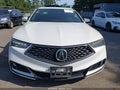 2019 Acura TLX — photo 12 of 17 | VIN 19UUB3F61KA001763
