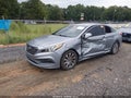 2016 Hyundai Sonata — photo 2 of 16 | VIN 5NPE34AF7GH314152