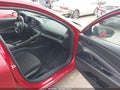 2025 Hyundai Elantra — photo 5 of 16 | VIN KMHLM4DG0SU889230