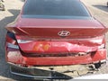 2024 Hyundai Elantra — photo 6 of 16 | VIN KMHLL4DG2RU792396