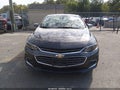 2017 Chevrolet Malibu — photo 12 of 16 | VIN 1G1ZE5ST1HF249938