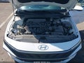 2024 Hyundai Elantra — photo 10 of 16 | VIN KMHLM4DG6RU696140